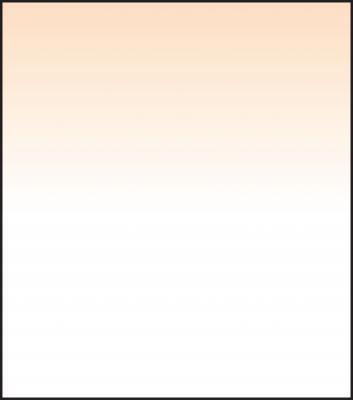 SW150 Coral 4 Grad Soft                 